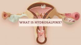 What Is Hydrosalpinx